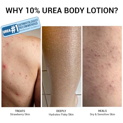 Sereko Urea Body Lotion with Avocado Oil | Detox & Exfoliation for Very Dry Skin