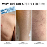 Sereko Urea Body Lotion with Avocado Oil | Detox & Exfoliation for Very Dry Skin
