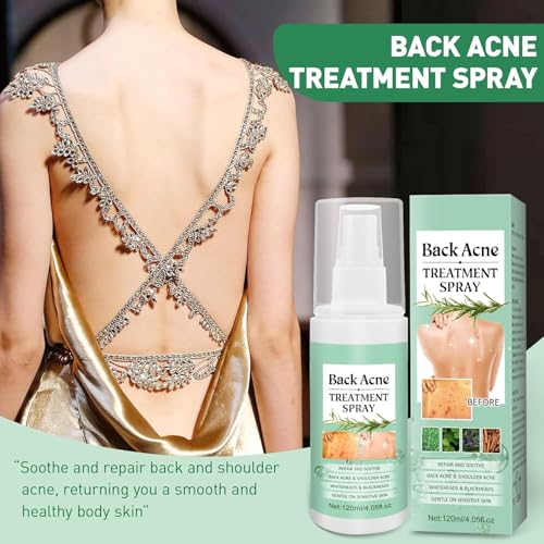 Azonee Back Acne Treatment Spray - Tea Tree, Salicylic Acid, 2% Aloe, 4 oz