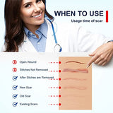 Medical Grade Silicone Scar Sheets for Scar Removal - 1.8 x 157 inches