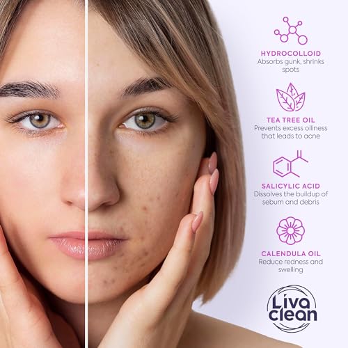 LivaClean 330 CT Pimple Patches with Salicylic Acid, Tea Tree Oil & Calendula Oil - Four Sizes