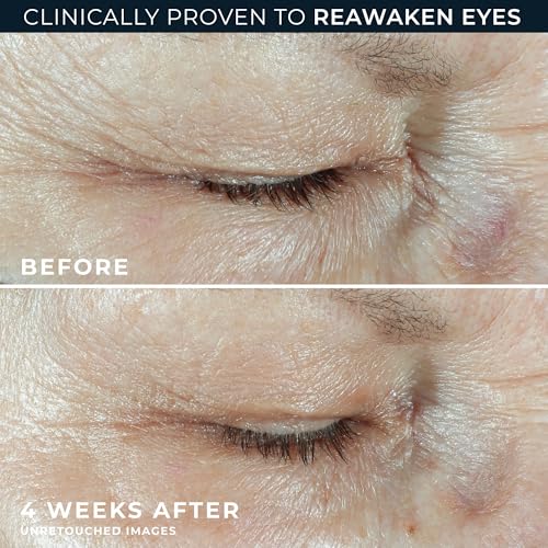RoC Multi Correxion Hyaluronic Acid + Retinol Capsules Eye Care Set