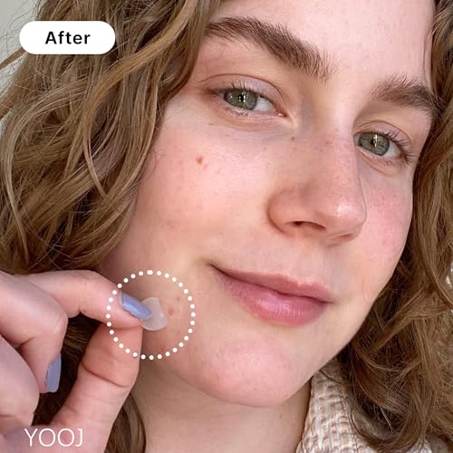 YOOJ® 96 Pcs Pimple Patches - Hydrocolloid Acne Absorbing Patches, Vegan & Cruelty Free, 3 Sizes
