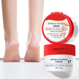 40% Urea Cream for Dry Foot & Cracked Heels - Moisturizing Repair with Hyaluronic Acid & Salicylic Acid