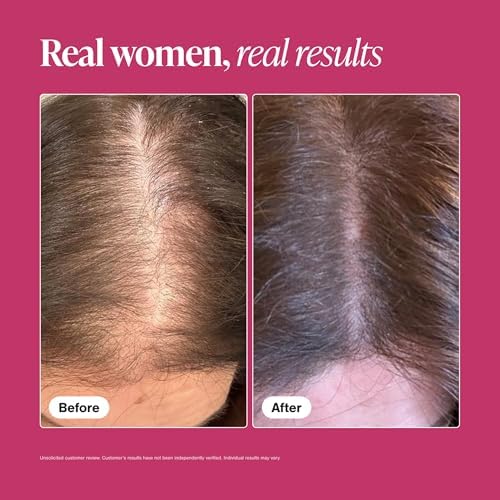 Viviscal Hair growth supplement for women, 60 Count