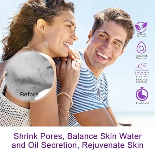 Azelaic Acid Serum Booster 12% with Hyaluronic Acid & Niacinamide - Balances Sebum, Smooths Skin & Cleanses Pores - 1pcs