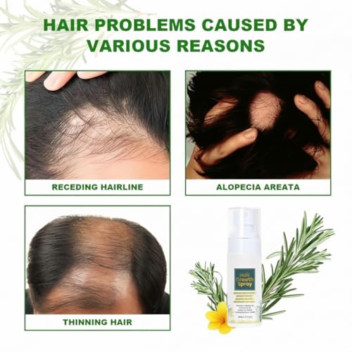 NALACAL Hair Growth Serum for Women - Natural Hair Loss Treatment & Repair