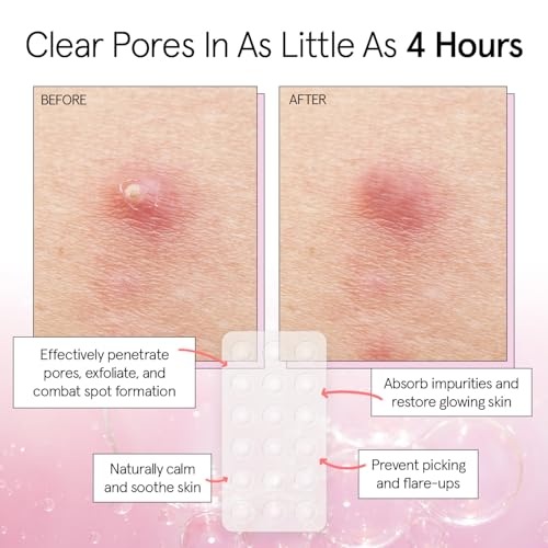 Grace & Stella Award-Winning Pore Strip - Hydrocolloid Acne Patches for Face, Invisible, 36 Count