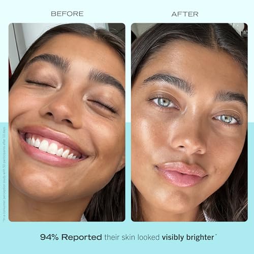 First Aid Beauty Ultra Repair Hydrating Moisturizer with Niacinamide - Rich Moisture, Sensitive Skin Friendly, 1.7 oz