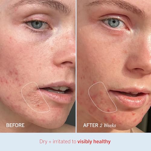 First Aid Beauty Ultra Repair Cream - Intense Hydration for Dry Skin, 2oz