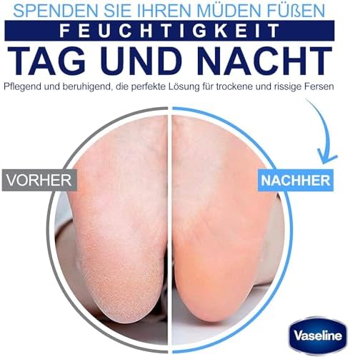 Vaseline Deep Moisture Foot Cream - Soft & Healthy Feet