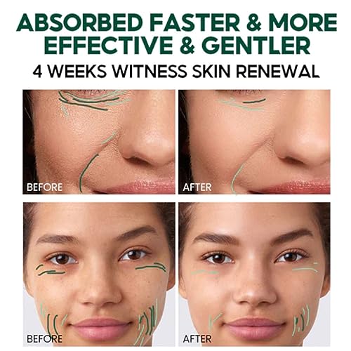 Anti-Aging Retinol Face Cream Set 4PCS - Complete Skincare Routine for Youthful Skin