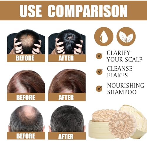 NALACAL Rice Water Shampoo Bar for Hair Growth & Strengthening | 2-in-1 Moisturizing & Repair | Solid Hair Soap