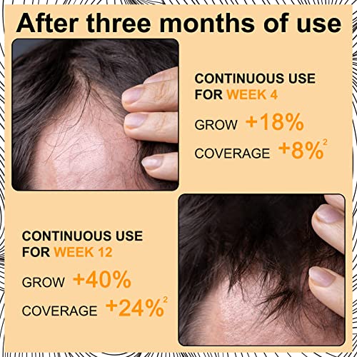 Hair Growth Foam & Serum for Men & Women - Anti-Hair Loss Treatment 60ml