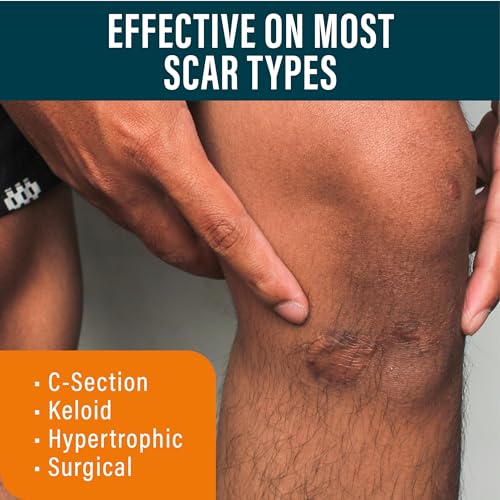 NUVADERMIS Post-Op Scar Gel - With Allantoin & Betaine for C-Section & Keloid Management