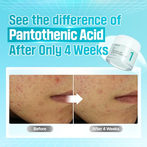 numbuzin Pantothenic Active Soothing Cream – Deep Hydration & Barrier Support with Panthenol | Calming Moisturizer for Sensitive & Dry Skin | Korean Skincare