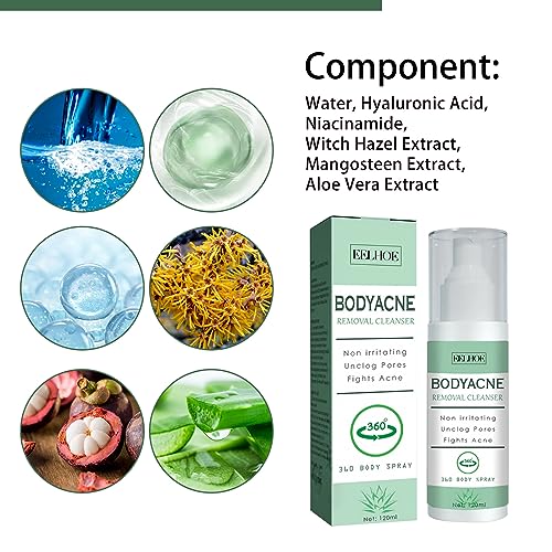 Body & Back Acne Spray with Salicylic Acid & Herbal Formula