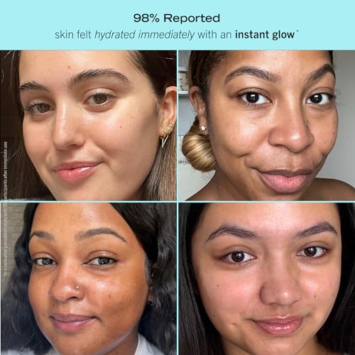 First Aid Beauty Ultra Repair Hydrating Moisturizer with Niacinamide - Rich Moisture, Sensitive Skin Friendly, 1.7 oz