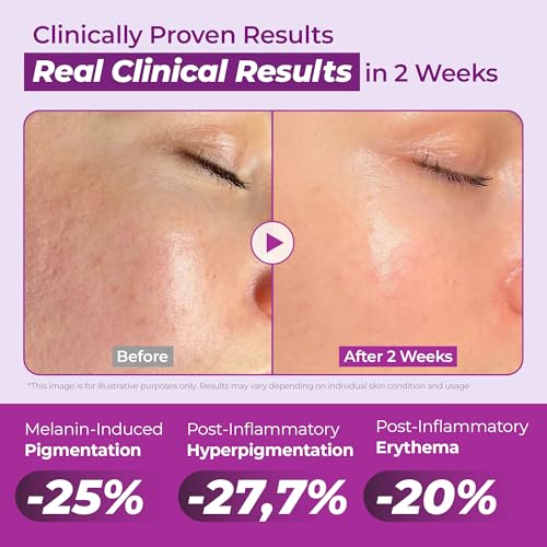 JUMISO Niacinamide 20% + Glutathione + TXA Serum - Korean Brightening Face Serum