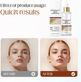 2 PCS Exfoliating Ampoule - Black & White Rice Duo for Glowing Skin | Brightening & Hydrating Peel
