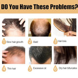 NALACAL Rice Water Shampoo Bar for Hair Growth & Strengthening | 2-in-1 Moisturizing & Repair | Solid Hair Soap