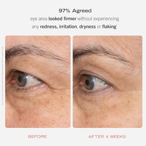 First Aid Beauty Retinol Eye Cream with Squalane & Ceramides (0.5 oz)