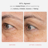 First Aid Beauty Retinol Eye Cream with Squalane & Ceramides (0.5 oz)