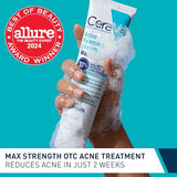 CeraVe Acne Foaming Cream Wash with Benzoyl Peroxide 10%, Hyaluronic Acid & Niacinamide - 5 oz