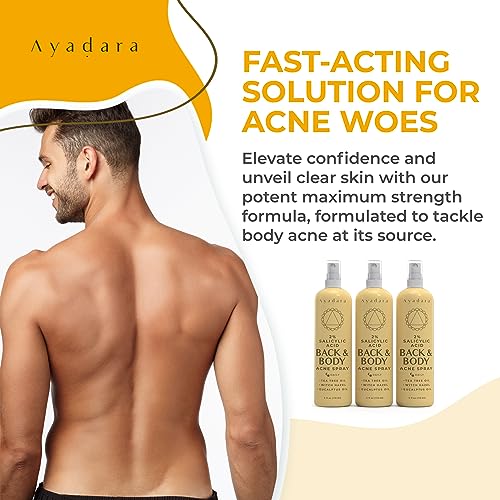 Acne Treatment Body Spray with Salicylic Acid for Back & Chest Acne, 3 Pack, Hormonal & Bacne Relief for Teens & Adults