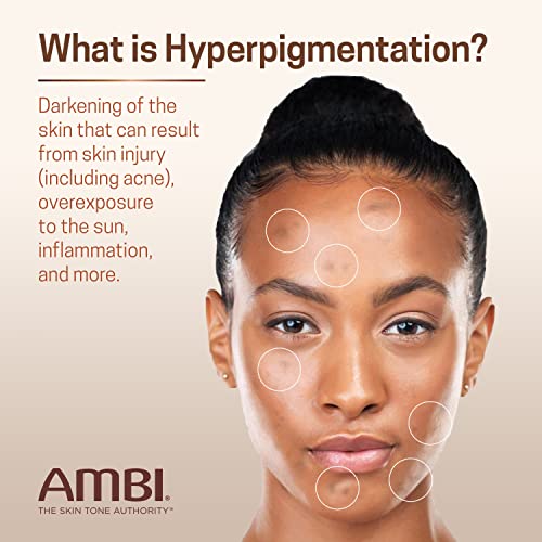 Ambi Even & Clear Fade Serum - Hydroquinone-Free Dark Spot Corrector with Retinol, Hyaluronic Acid, Niacinamide & Ceramides