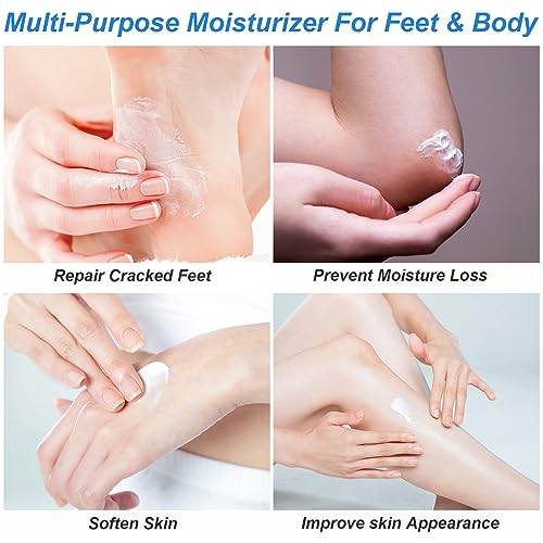 Urea Cream Plus Salicylic Acid - Foot & Hand Repair Treatment 7.06oz