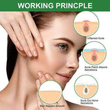 ELAIMEI Invisible Acne Pimple Healing Patch - Hydrocolloid Spot Treatment for Blemishes, 3 Sizes, Blends with Skin