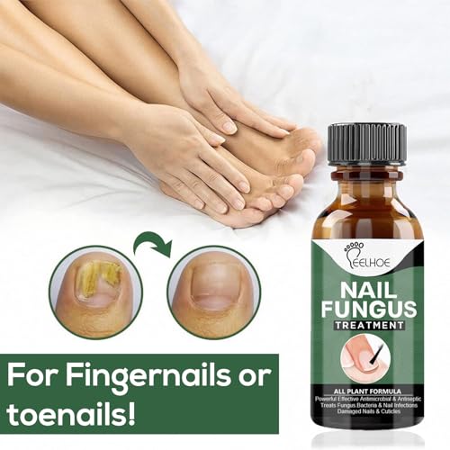 WINDALY® Premium Anti-Fungus Nail Treatment Oil for Toenails (50ml)