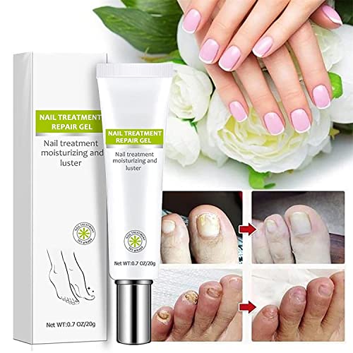 Flyles Nail Repair Gel for Damaged Nails, 2 Pack