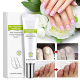Flyles Nail Repair Gel for Damaged Nails, 2 Pack