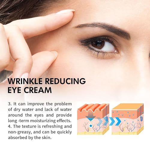 ALMEKAQUZ Retinol Intense Reactivating Eye Cream - Anti Aging, Puffiness Remover, Dark Circles, Skin Brightening