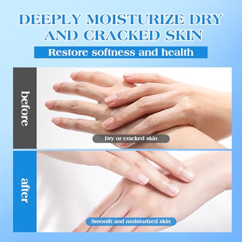42% Urea Cream for Dry & Cracked Skin - Maximum Strength Foot & Hand Repair with Salicylic Acid & Natural Oils