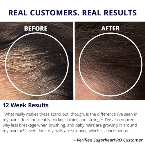 SugarBearHair Vitamins - Hair Growth & Nail Support (1 Month Supply)