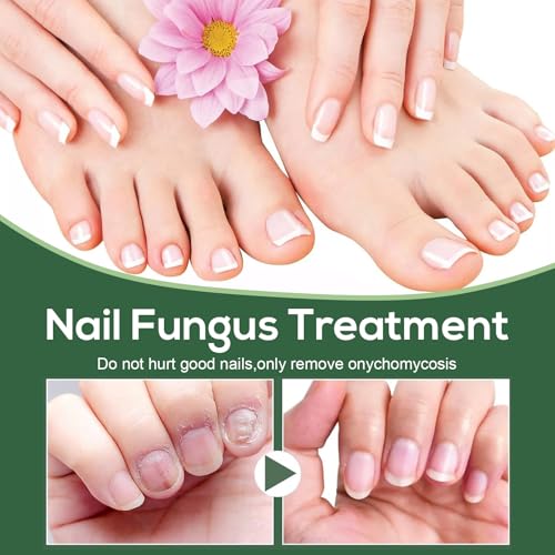 WINDALY® Premium Anti-Fungus Nail Treatment Oil for Toenails (50ml)