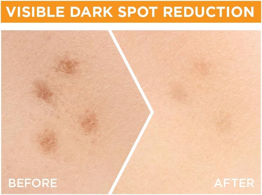 Garnier Vitamin C + Niacinamide Dark Spot Serum - 30ml