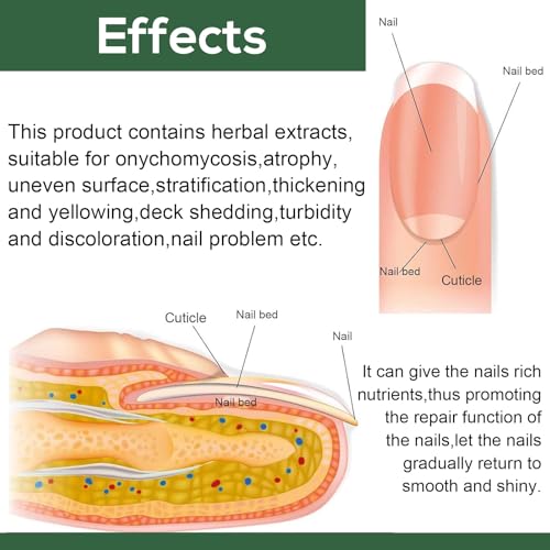 WINDALY® Premium Anti-Fungus Nail Treatment Oil for Toenails (50ml)