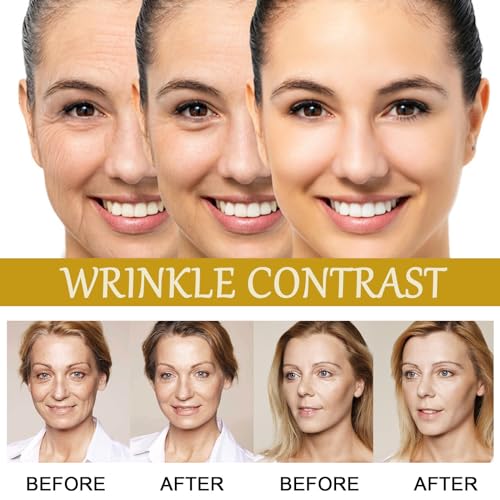 Advanced Bee Venom Anti-Wrinkle Serum - Multi-Peptide & Hyaluronic Acid Essence