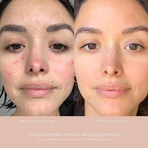 Summer Fridays CC Me Serum: Brightening Vitamin C Serum