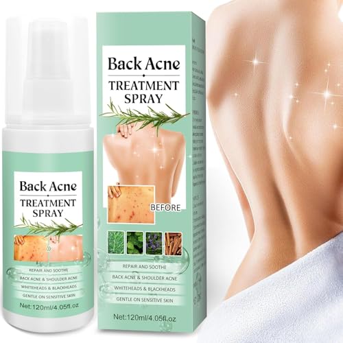 Azonee Back Acne Treatment Spray - Tea Tree, Salicylic Acid, 2% Aloe, 4 oz