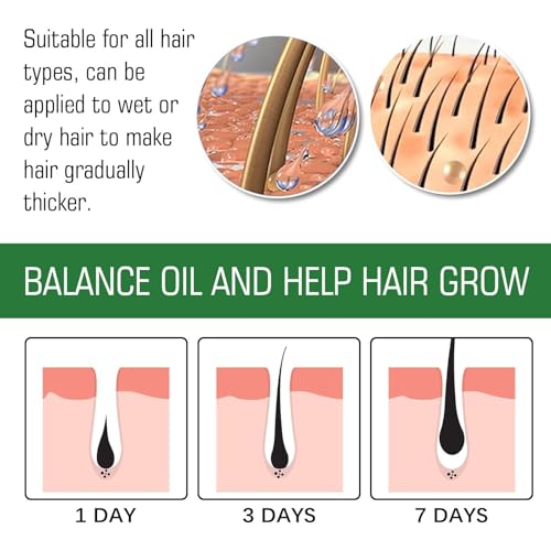 NALACAL Hair Growth Serum for Women - Natural Hair Loss Treatment & Repair