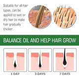 NALACAL Hair Growth Serum for Women - Natural Hair Loss Treatment & Repair