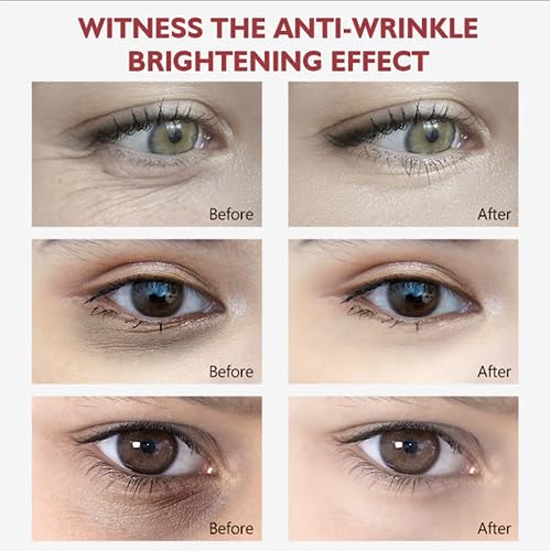 Vibrant Glamour Retinol Eye Cream: Reduce Dark Circles & Fine Lines