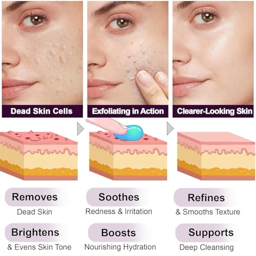 Exfoliant Rice Ampoule - Pore Minimizer & Blackhead Remover with Niacinamide, PHA & Salicylic Acid | Brightening Serum for Oily Skin