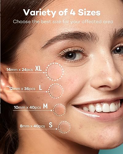 TKTK Acne Patch Pimple Patch - 4 Sizes, 140 Patches with Tea Tree & Calendula Oil