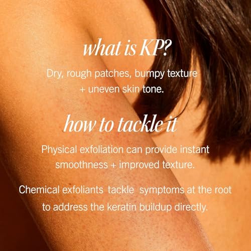 First Aid Beauty KP Bump Eraser Exfoliating Body Scrub, 10% AHA, 226g